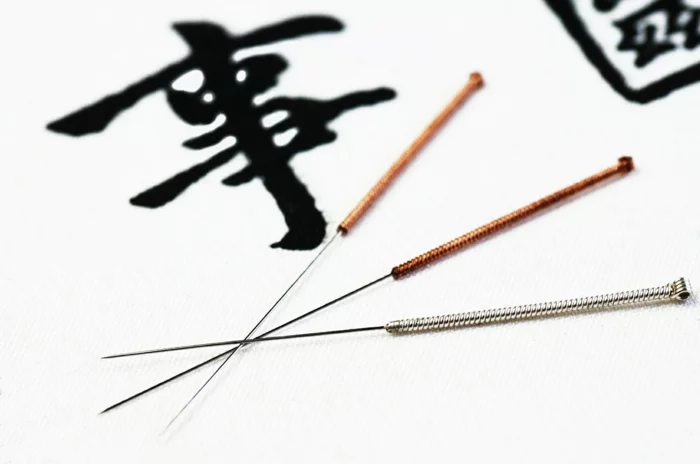chinesische medizin Abnehmen Akupunktur nadeln