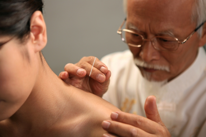 chinesische medizin Abnehmen Akupunktur pünkte