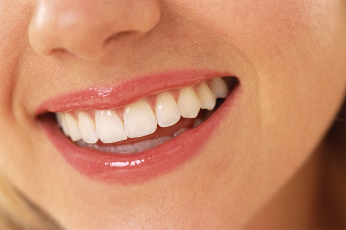karies symptome richtige zahnpflege schönes lächeln