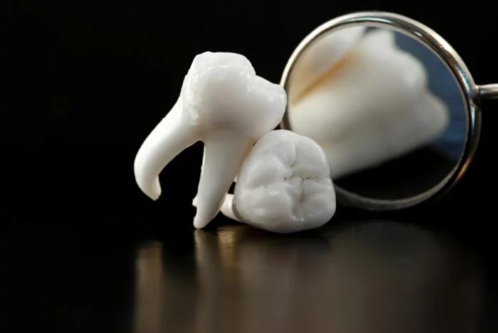 richtige zahnpflege karies vermeiden ursachen