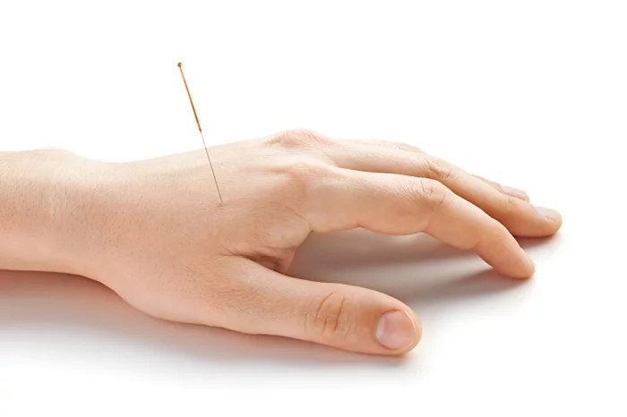 ständig kopfschmerzen tipps akupunktur lifestyle