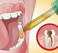 8 zuverlässige Hausmittel gegen Zahnschmerzen – für den Fall der Fälle!