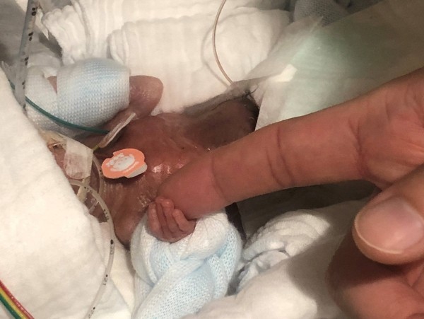 Kleinste Baby der Welt, das bei Geburt nur 268 Gramm wog, geht nach Hause intensivstation hand vergleich