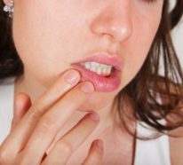 Apfelallergie: Das sind die häufigsten Symptome, die auftreten können