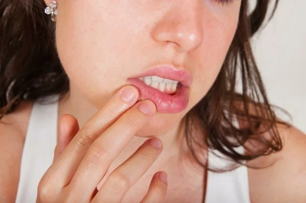 Apfelallergie Symptome Lippen Schwellungen Apfelsorten