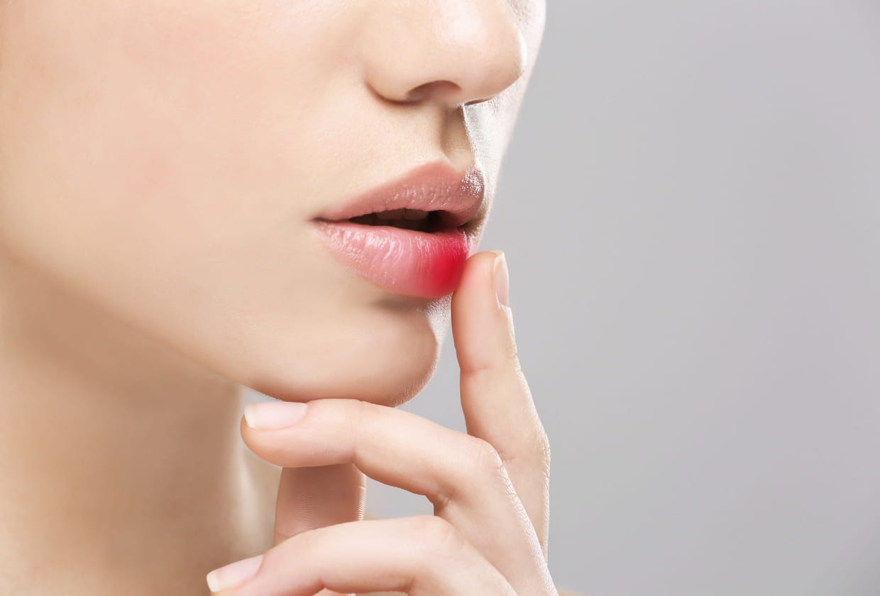 Lippenherpes Hausmittel Was Hilft Gegen Fieberblaschen An Der Lippe