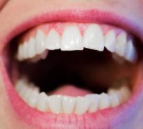 Tipps für gesundes Zahnfleisch und ein schönes Lächeln