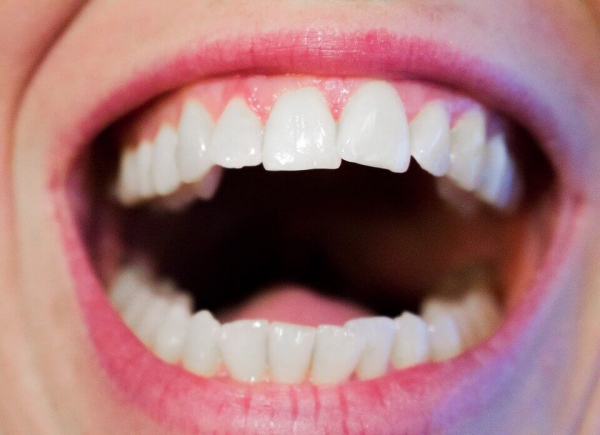 Tipps für gesundes Zahnfleisch und ein schönes Lächeln gute mund hygiene weiße zähne