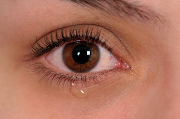 Brennende Augen haben Mögliche Ursachen und nützliche Tipps trockene Augen