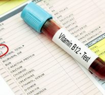Vitamin B12 Mangel: Ursachen, Symptome und Maßnahmen, die dagegen helfen können