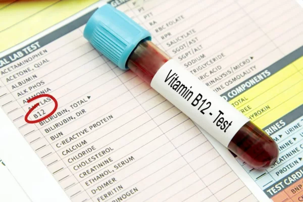 vitamin b12 mangel test
