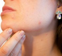 Make-up bei Akne & unreiner Haut: die besten Schminktipps