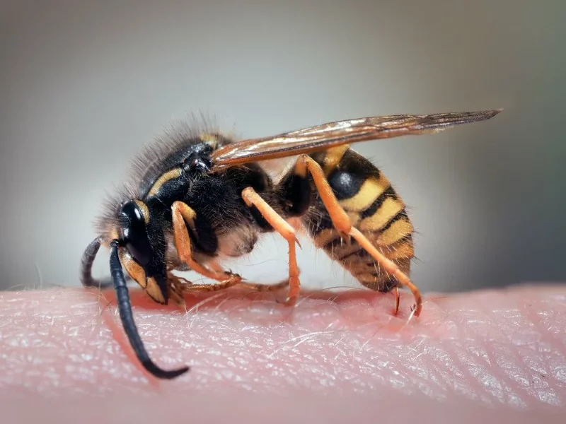 Wespenstich – So lindern Sie schnell die Schmerzen! stich wespe hand