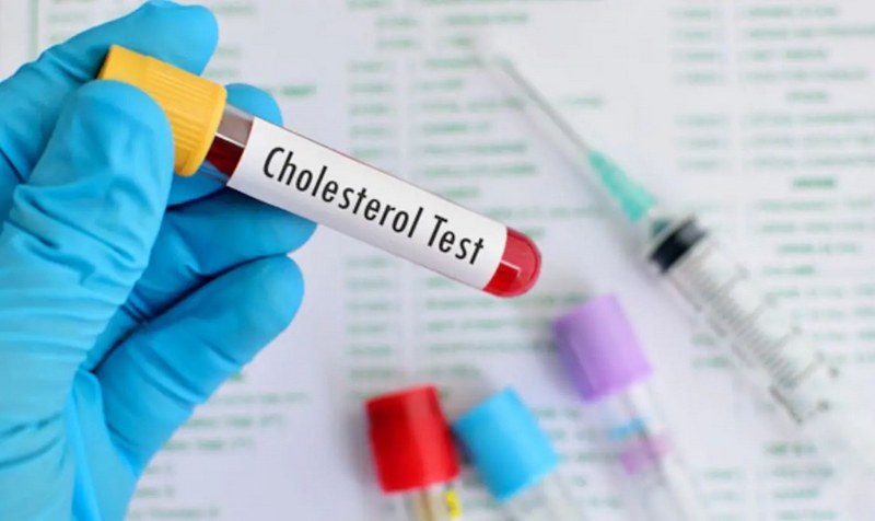 Cholesterinspiegel senken Bluttest machen Tipps