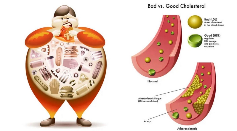 Cholesterinspiegel senken Gesundheitstipps