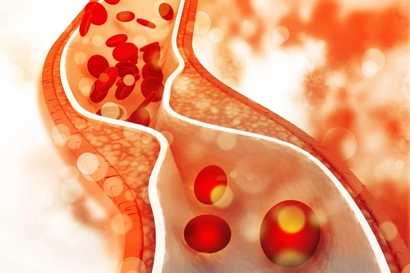 Cholesterinspiegel senken Tipps Cholesterin im Blut